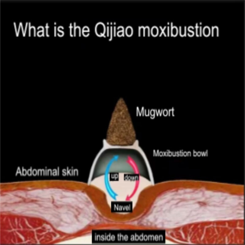 Flag Village Qi Jiao Moxibustion Gift Box Set