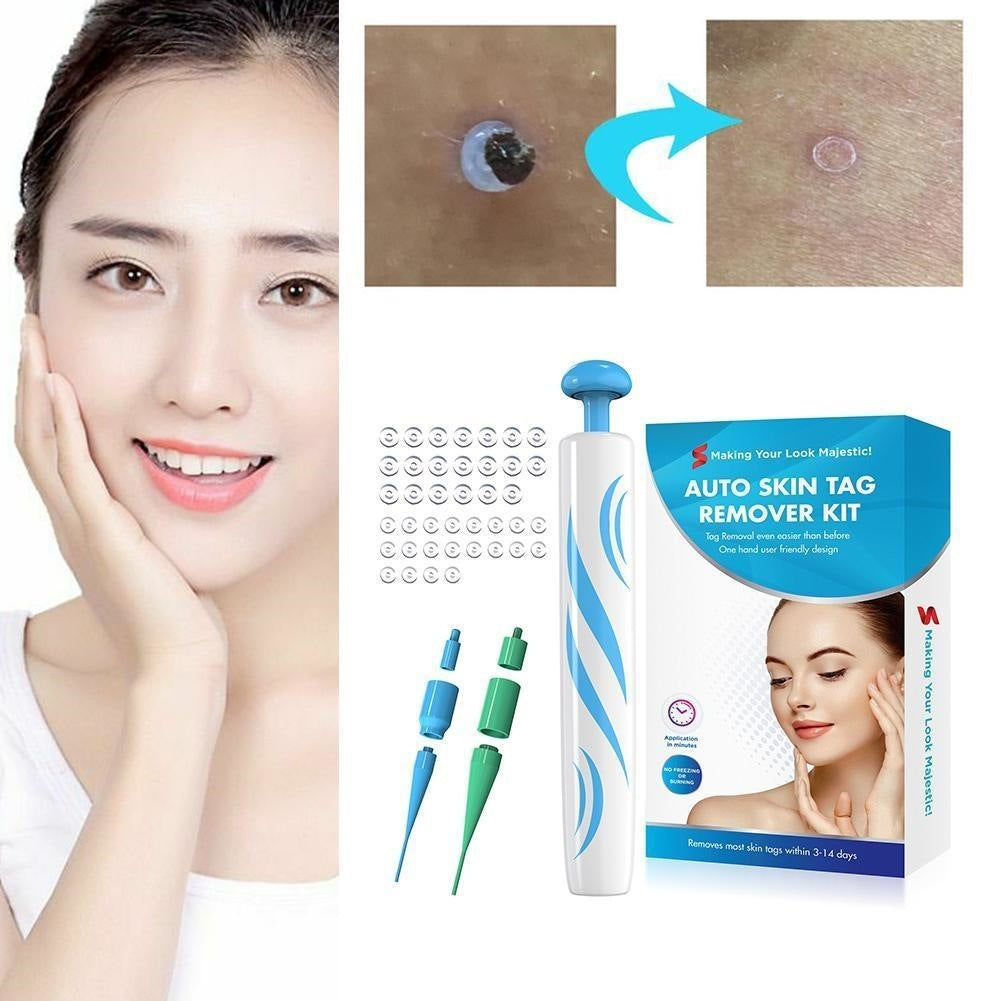 Flag Village Auto Tools Auto Skin Tag Remover Painless Facial Beauty Tools Mole Wart