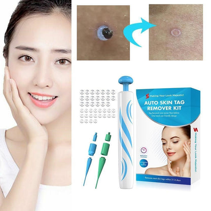 Flag Village Auto Tools Auto Skin Tag Remover Painless Facial Beauty Tools Mole Wart